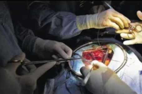 UP doctors remove 5.5 kg tumour from woman’s kidney