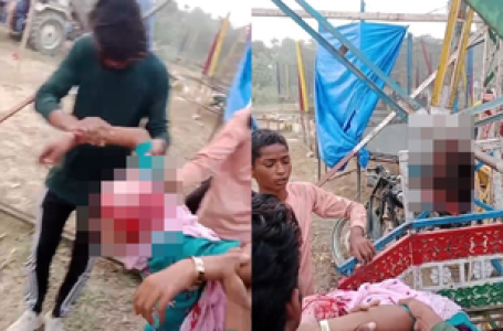 Girl’s hair gets entangled in swing’s rod in Uttar Pradesh; scalp ripped off