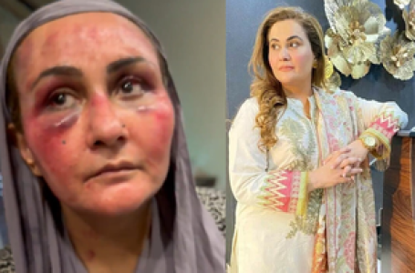 Hit with gun and dragged by hair, Pakistani actress reveals brutal torture